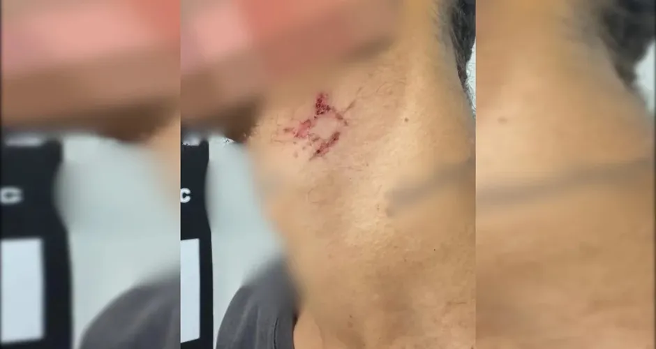 Escravo sexual é resgatado após passar mais de um ano em cárcere