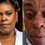 Cacau Protásio Sofre Cegueira Temporária e Faz Alerta Sobre Pomadas Capilares