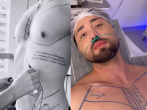 Rico Melquiades Investe R$ 150 Mil em Novas Plásticas: “Sou do Centro Cirúrgico”