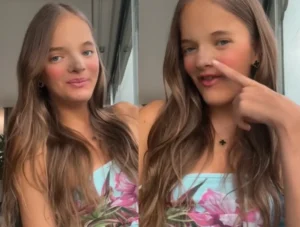 Rafaella Justus Choca a Internet com Nova Rinoplastia e Manda a Real